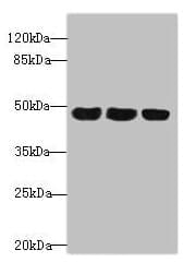 Polyclonal Rabbit anti-Human TXNDC5 / ERP46 Antibody (IHC, WB)