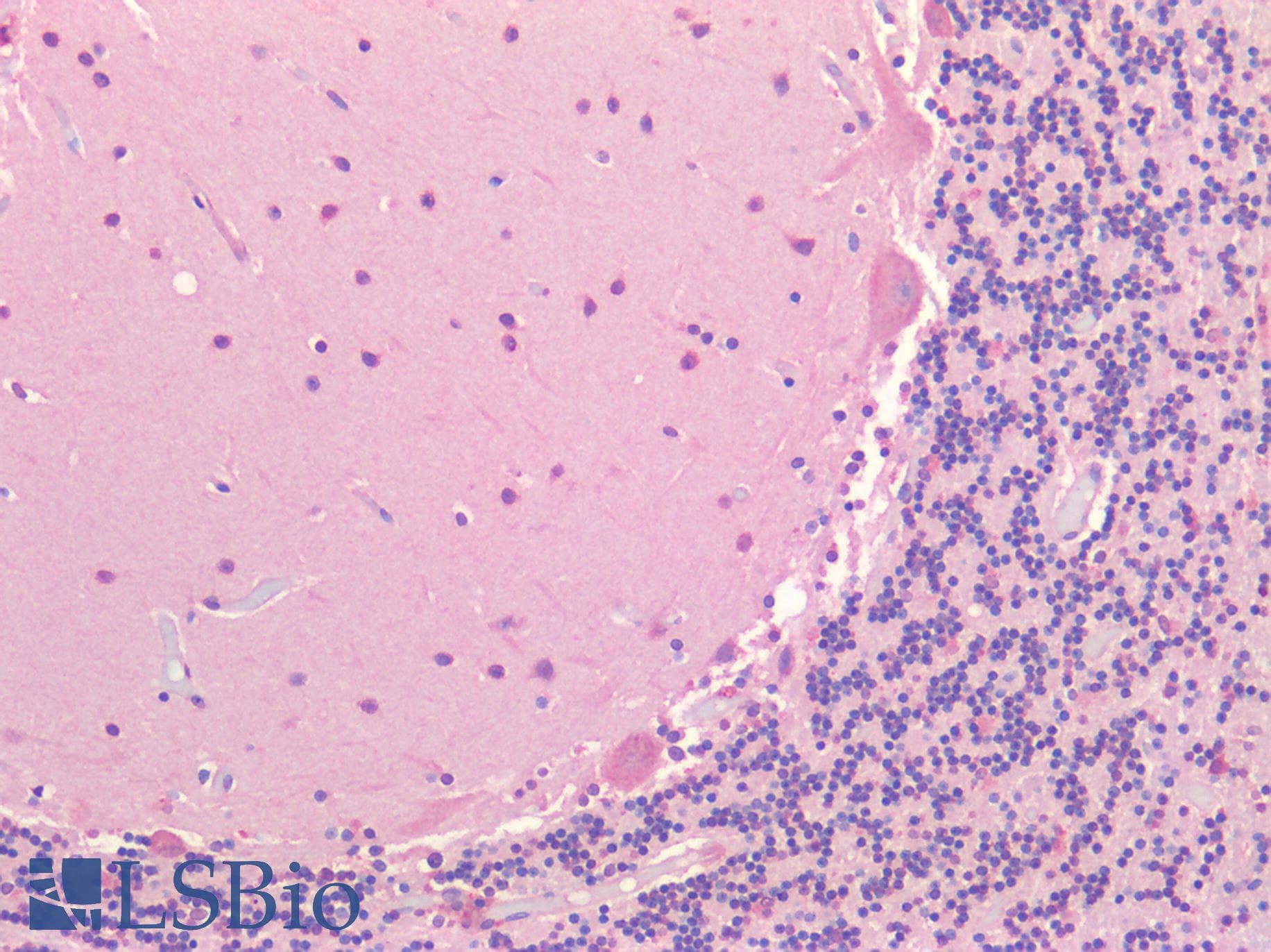 IHC-plus™ Polyclonal Rabbit anti-Human FOLH1 / PSMA Antibody (IHC)