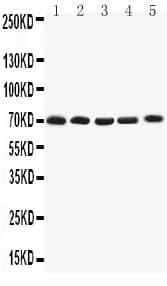 Polyclonal Rabbit anti-Human KCNA4 / Kv1.4 Antibody (aa329-344, WB)