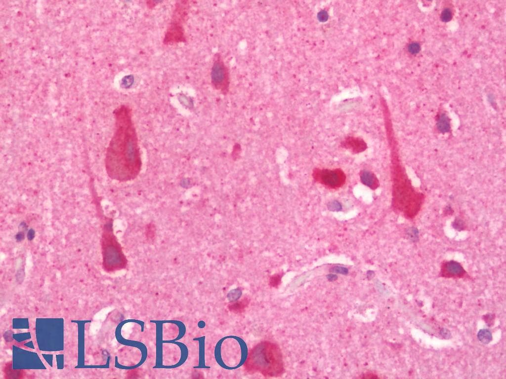 IHC-plus™ PACS2 Antibody