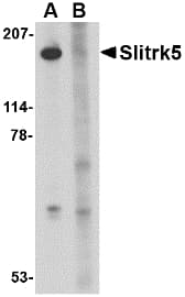 Polyclonal Rabbit anti-Human SLITRK5 Antibody (IHC, IF, WB)