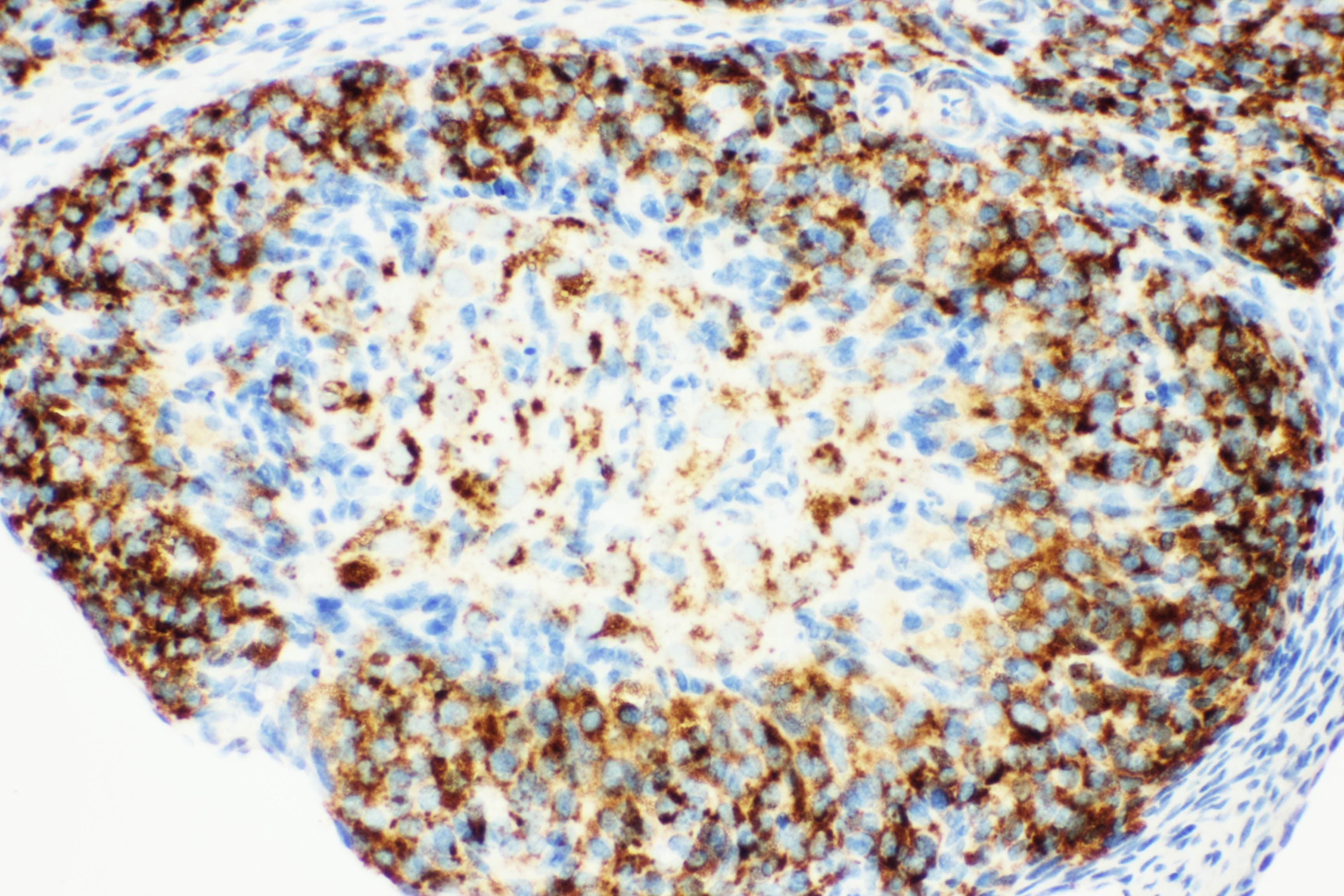 Polyclonal Rabbit anti-Human HSD17 / HSD17B1 Antibody (aa29-43, IHC, WB)