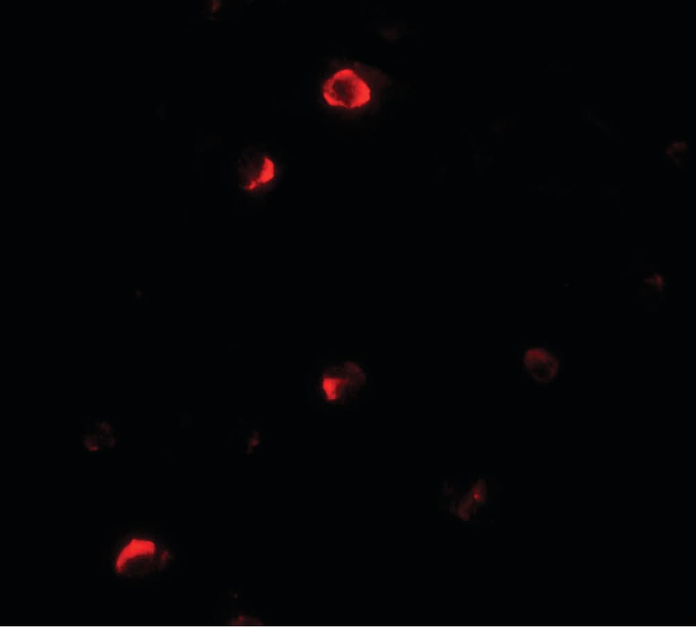 IHC-plus™ PELI1 / Pellino 1 Antibody