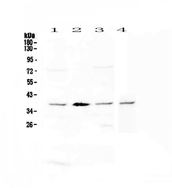 AHSA1 / AHA1 Antibody