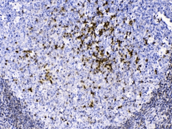 CCS Antibody