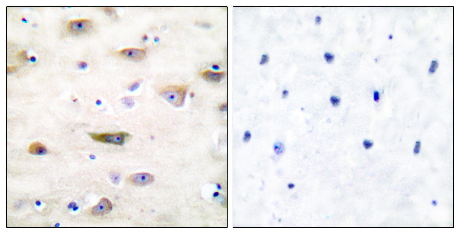 GRIA2 / GLUR2 Antibody (p880)