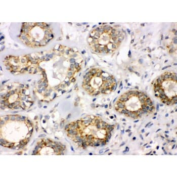 B3GNT8 Antibody (aa360-397)