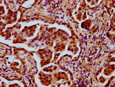 Polyclonal Rabbit anti-Human TAF4B Antibody (IHC, IF)
