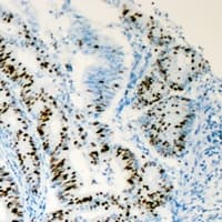 HNF4A / HNF4 Antibody (Internal)