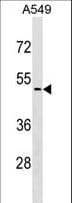 Polyclonal Rabbit anti-Human CDKL4 Antibody (aa277-304, WB)