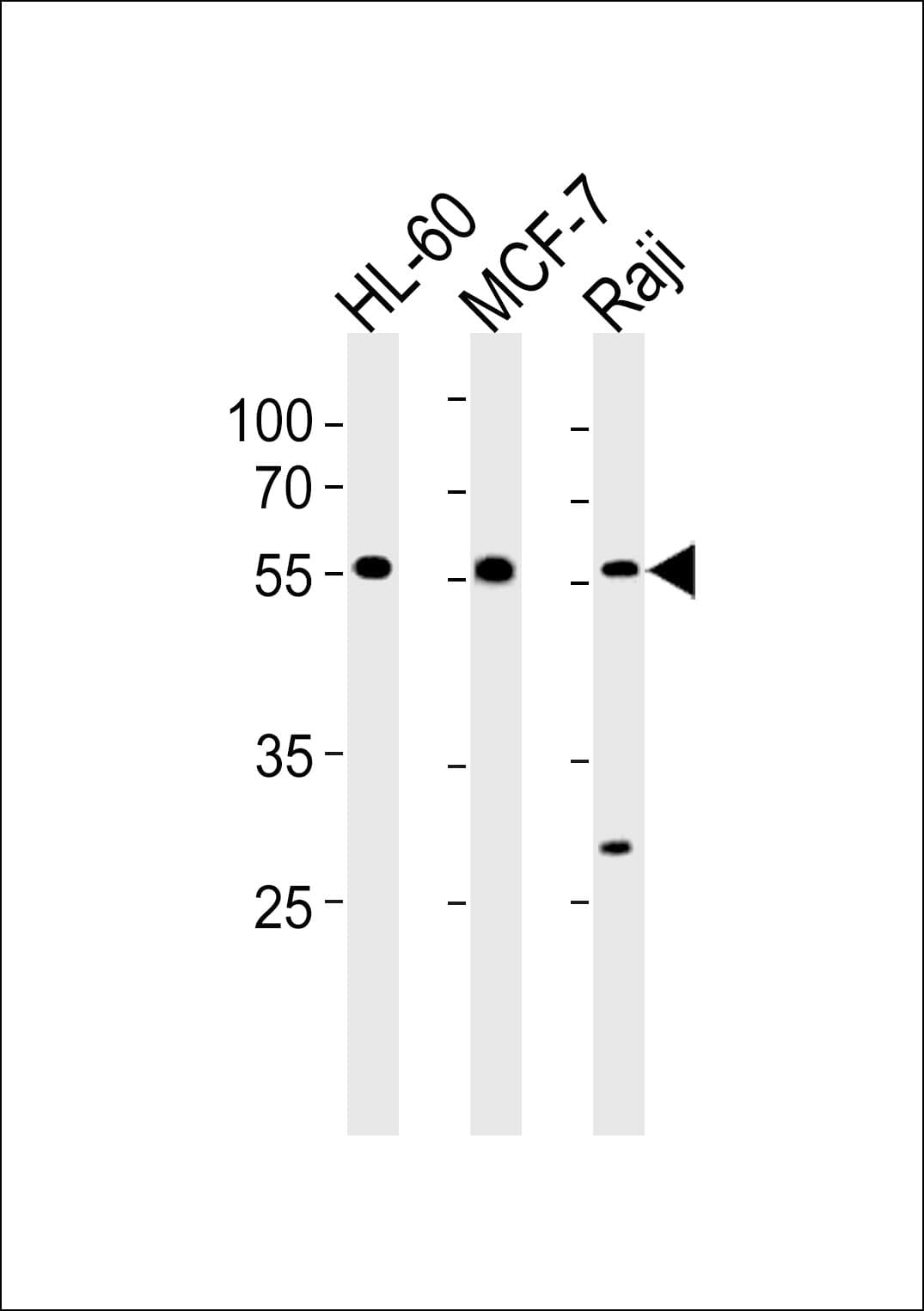 C16orf71 Antibody (aa320-348)