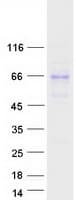 Human DYM Protein (Recombinant Myc-DDK (Flag))