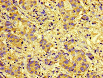 Polyclonal Rabbit anti-Human CXCR5 Antibody (IHC, IF)