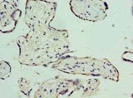 Polyclonal Rabbit anti-Human SLC25A15 / ORNT1 Antibody (aa1-301, IHC, WB)