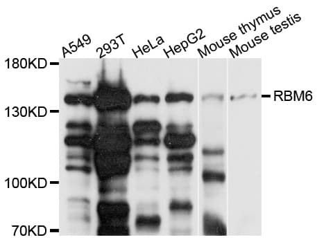 RBM6 / 3G2 Antibody