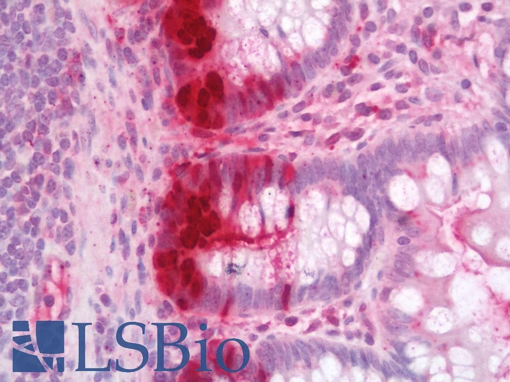 IHC-plus™ REG3A Antibody