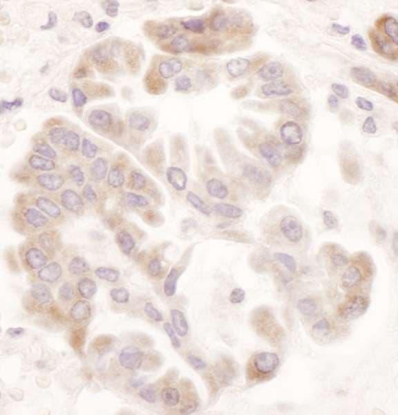 Polyclonal Rabbit anti-Human MTHFR Antibody (aa1-50, IHC)