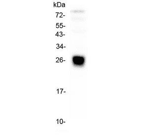 Polyclonal Rabbit anti-Human IGLL1 / CD179b Antibody (IHC, WB)