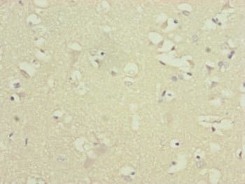 ATP5D Antibody