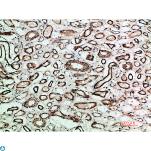 Polyclonal Rabbit anti-Human TGFB2 / TGF Beta2 Antibody (IHC, WB)