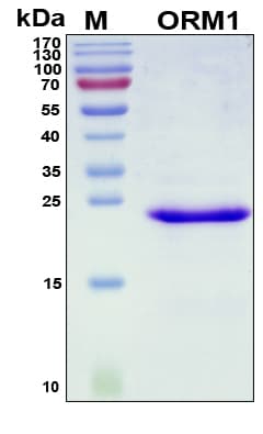 Human ORM1 / Orosomucoid Protein (Recombinant His, N-Terminal)