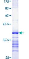Human Obscurin / OBSCN Protein (Recombinant GST, N-terminus)