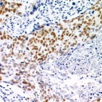 CHEK2 / CHK2 Antibody