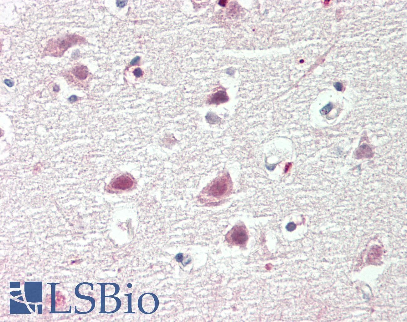 CBX4 Antibody (aa53-102)