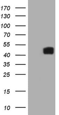 IL12B / IL12 p40 Antibody (clone OTI1A3, Carrier-free)