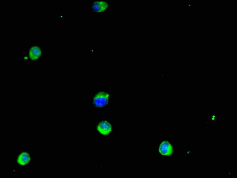 GSTM1 Antibody
