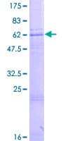 Human ZDHHC15 Protein (Recombinant GST)