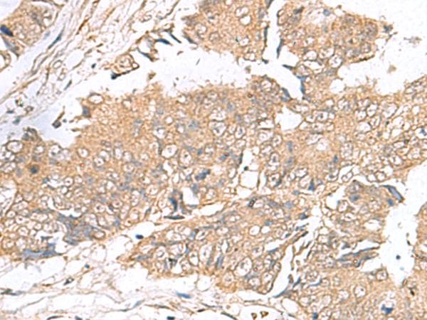 Polyclonal Rabbit anti-Human ARF5 Antibody (IHC)