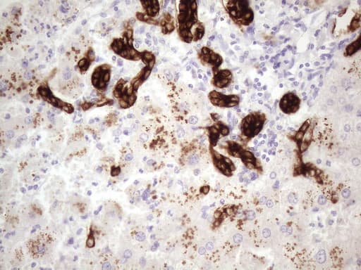 KRT16 / CK16 / Cytokeratin 16 Antibody (clone 7A4, Carrier-free)