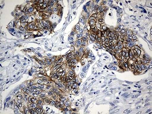CEP72 Antibody (clone OTI4D2)