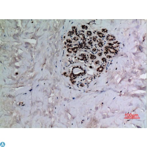 TP53 / p53 Antibody