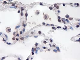 Monoclonal Mouse anti-Human PECAM-1 / CD31 Antibody (clone OTI8A9, IHC, WB)
