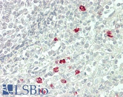 IHC-plus™ P2RY4 / P2Y4 Antibody (Internal)