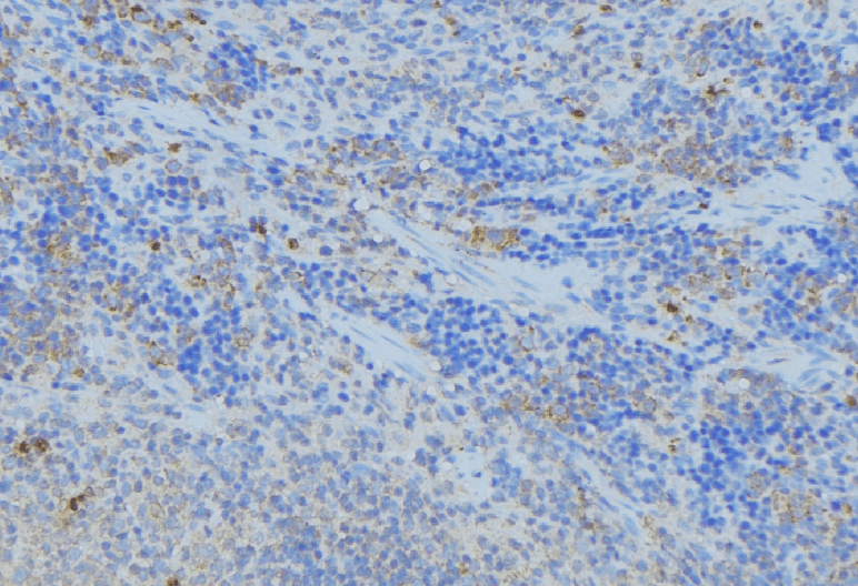 Polyclonal Rabbit anti-Human PPA1 Antibody (IHC, WB)