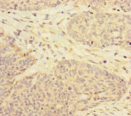 RBM17 Antibody