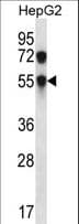 GALNAC4ST1 / CHST8 Antibody (aa219-247)