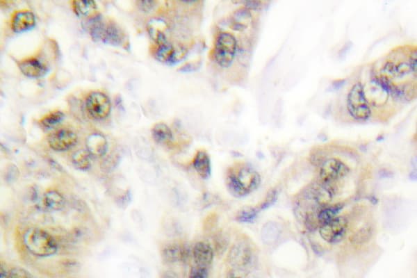 SSB / La Antibody (Thr362)