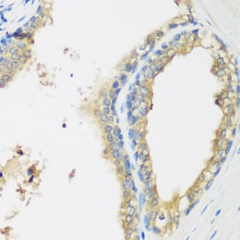 Polyclonal Rabbit anti-Human WDR77 / MEP50 Antibody (IHC, IF, WB)