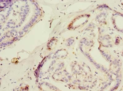 Polyclonal Rabbit anti-Human USP30 Antibody (aa101-400, IHC)