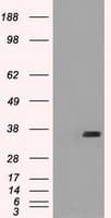 Monoclonal Mouse anti-Human CD32A Antibody (clone OTI15G5, IHC, IF, WB)