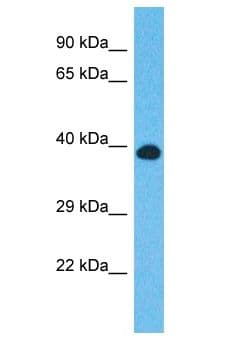 Polyclonal Rabbit anti-Human CCDC92 Antibody (aa51-100, WB)