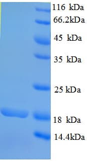 Human RHBDL2 / RRP2 Protein (Recombinant His)