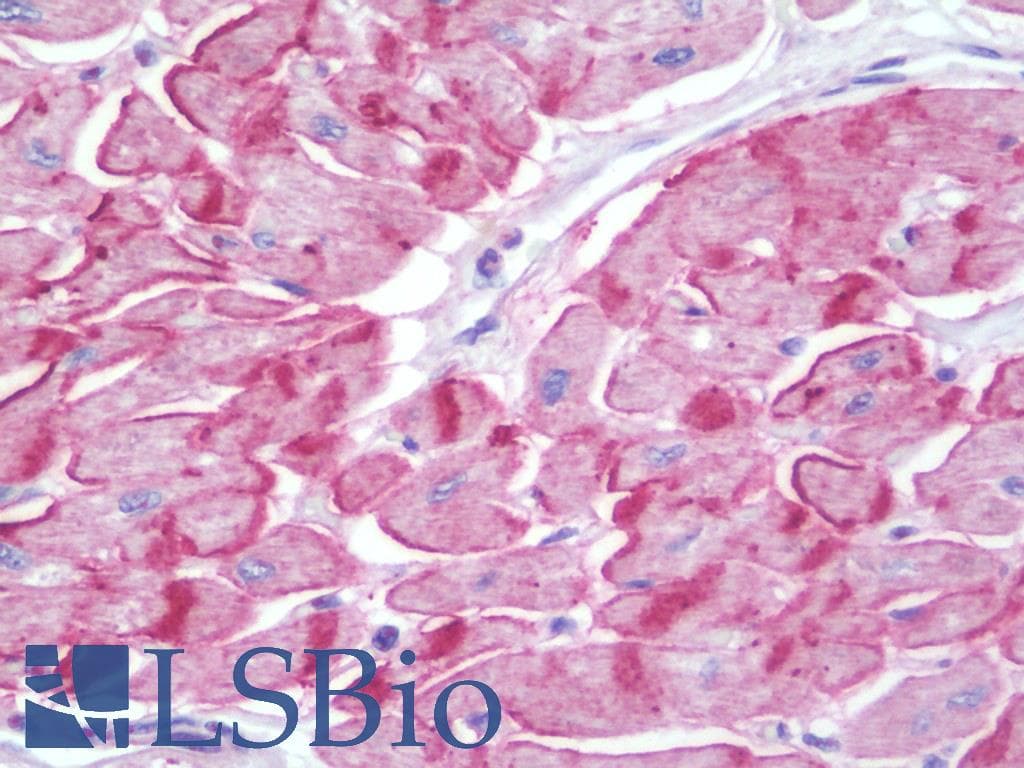 IHC-plus™ LRRC41 Antibody (aa391-440)