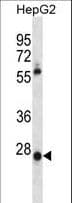 MEOX1 Antibody (aa136-165)