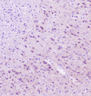 RASAL1 / RASAL Antibody