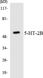 HTR2B / 5-HT2B Receptor Antibody (aa233-282)